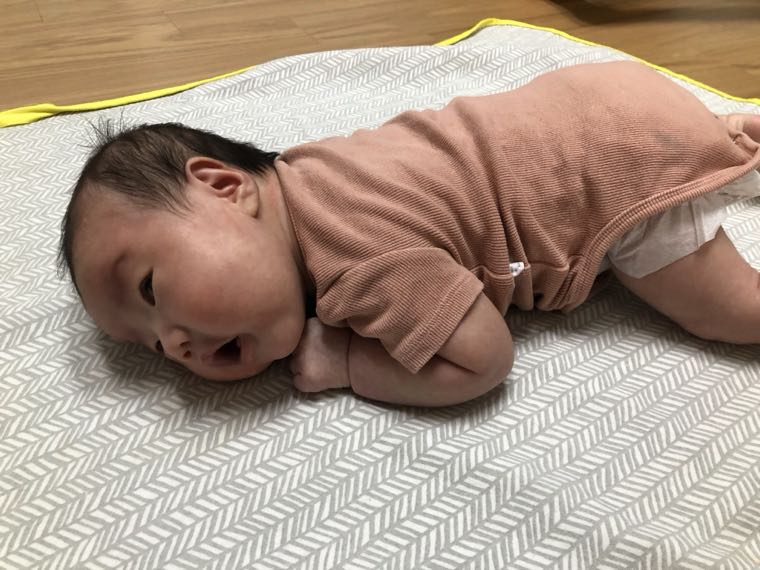 Newborn Head Asymmetry Self-Check | Normal Range by Month and Signs to See a Doctor